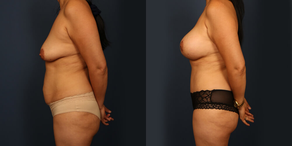 Before and After Image