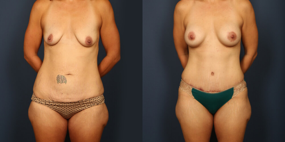 Before and After Image