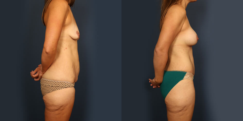 Before and After Image