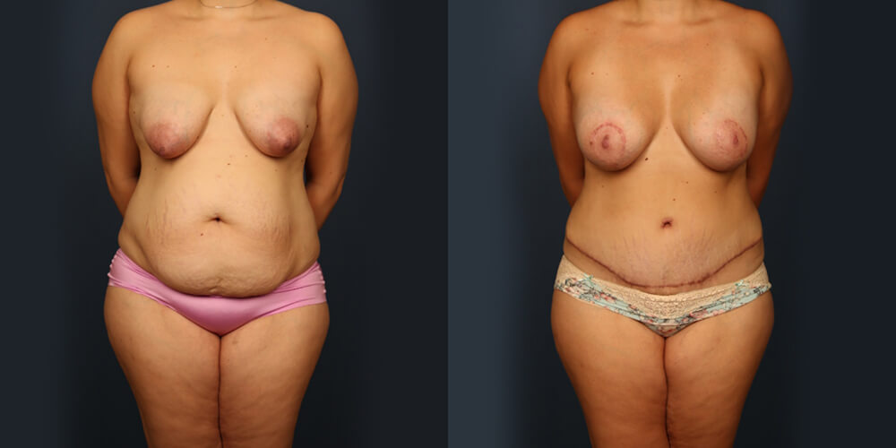 Before and After Image