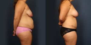 Before and After Image