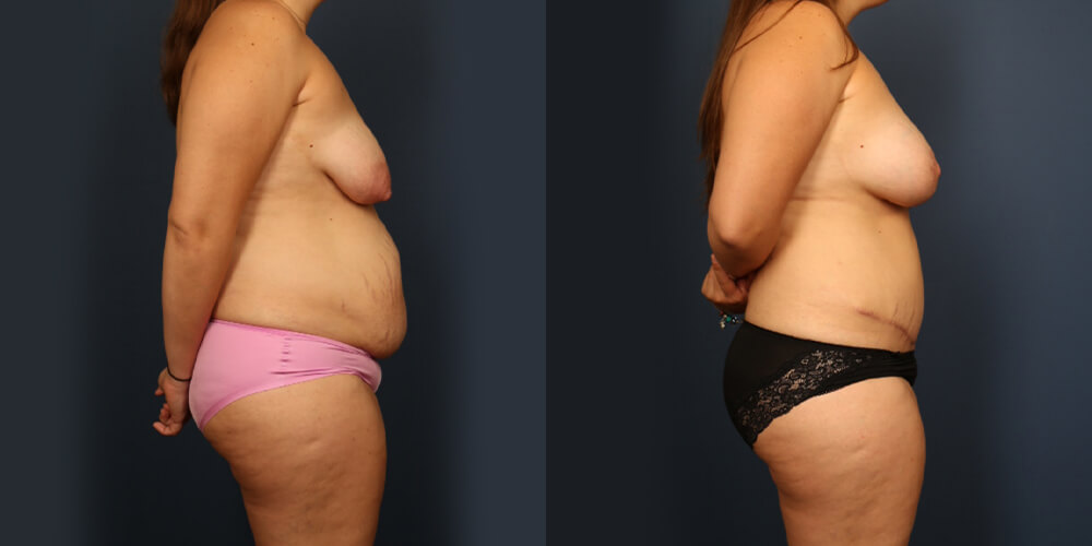 Before and After Image