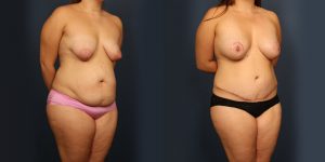 Before and After Image