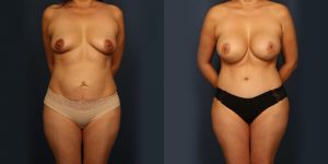 Before and After Image