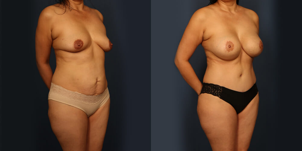 Before and After Image