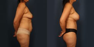 Before and After Image