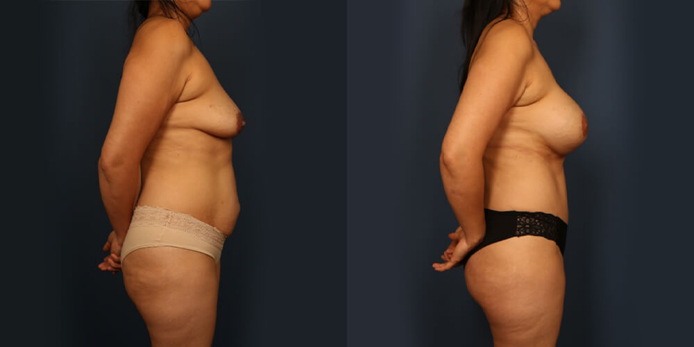 Before and After Image