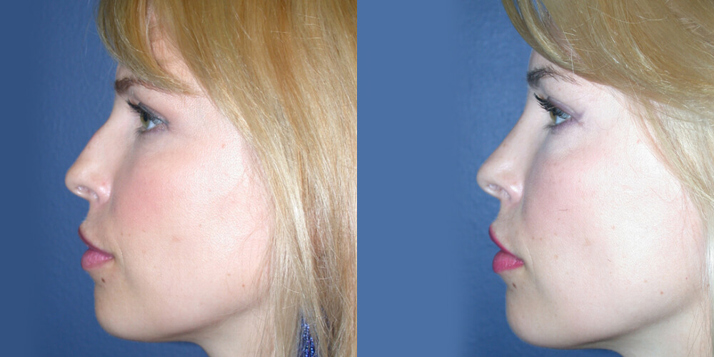 Before and After Image