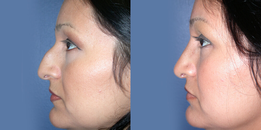 Before and After Image