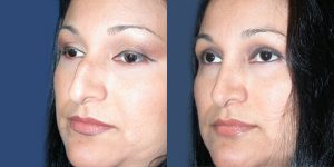 Before and After Image