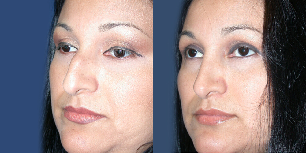 Before and After Image