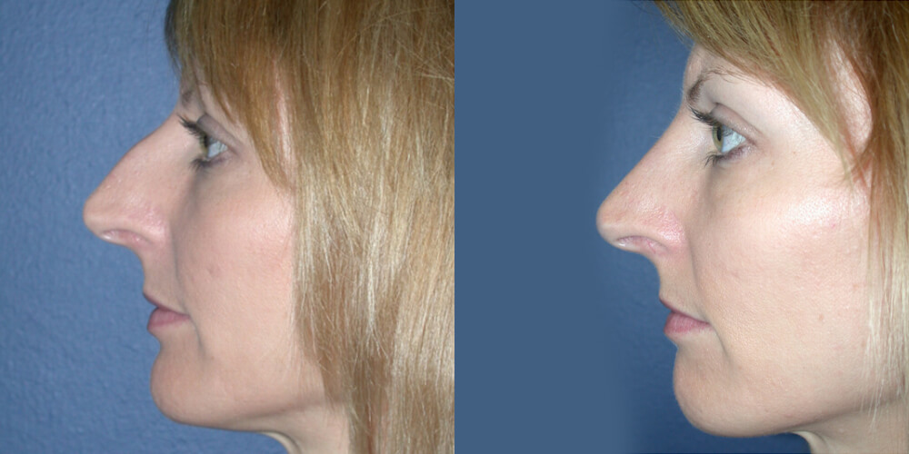 Before and After Image