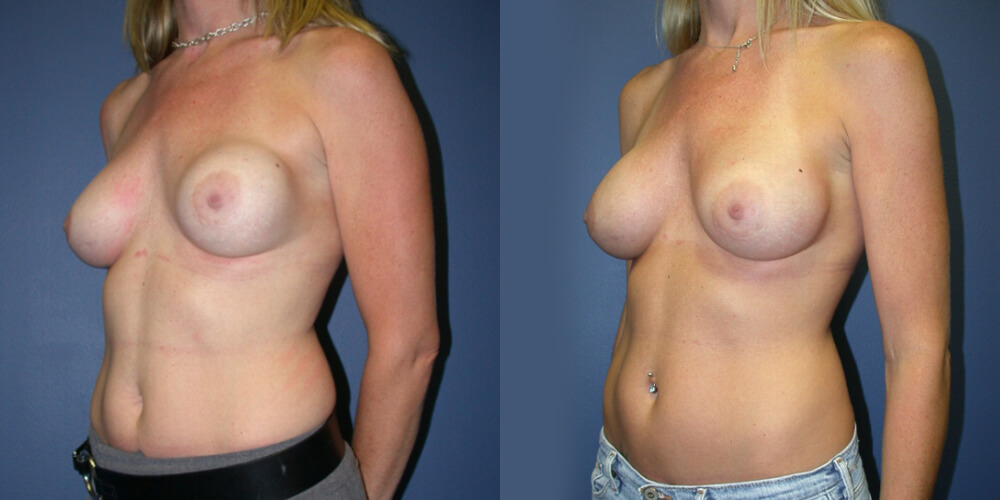 Before and After Image