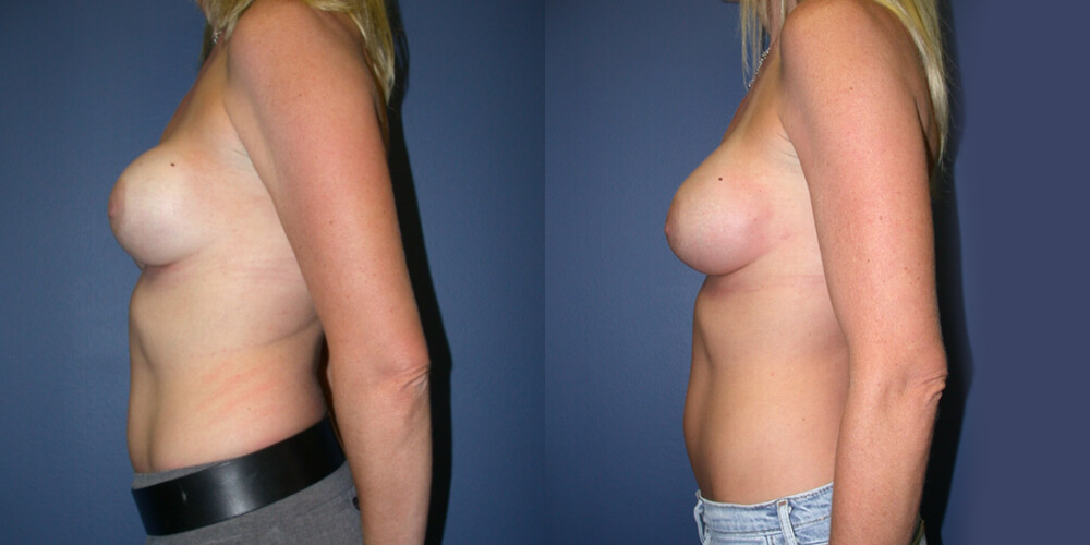 Before and After Image