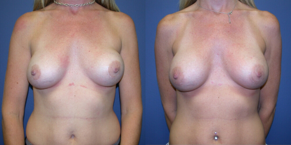 Before and After Image