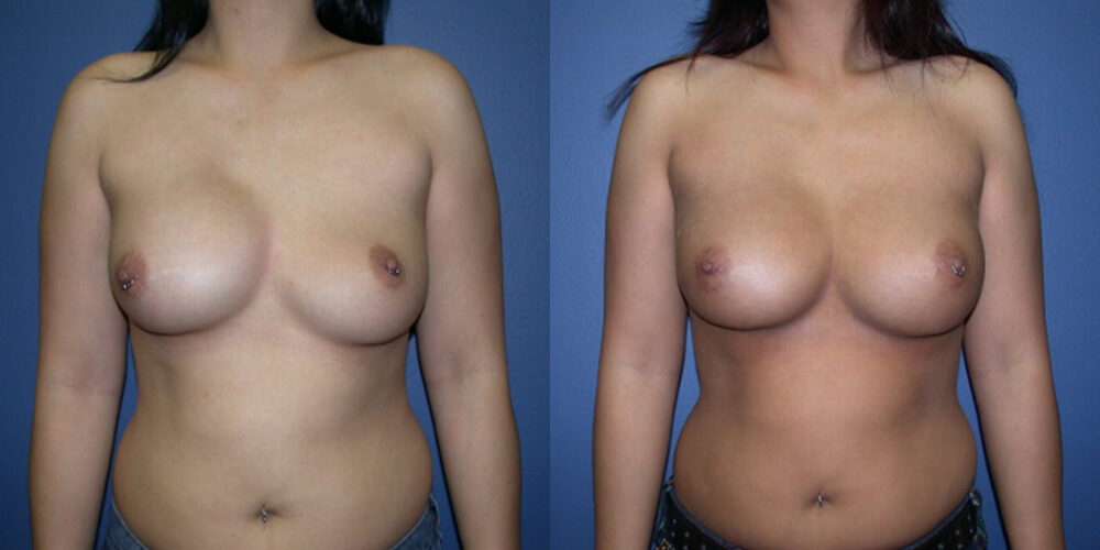 Before and After Image