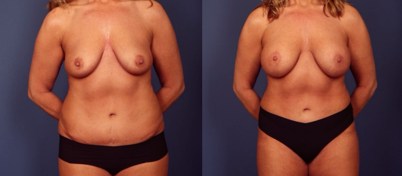 Before and After Image