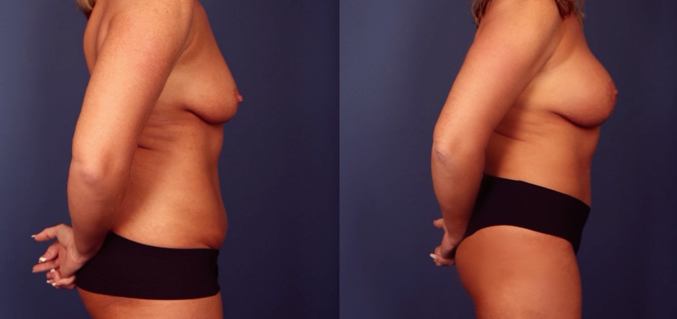 Before and After Image