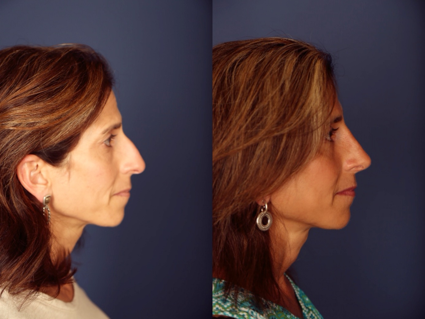 Before and After Image