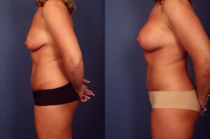 Before and After Image