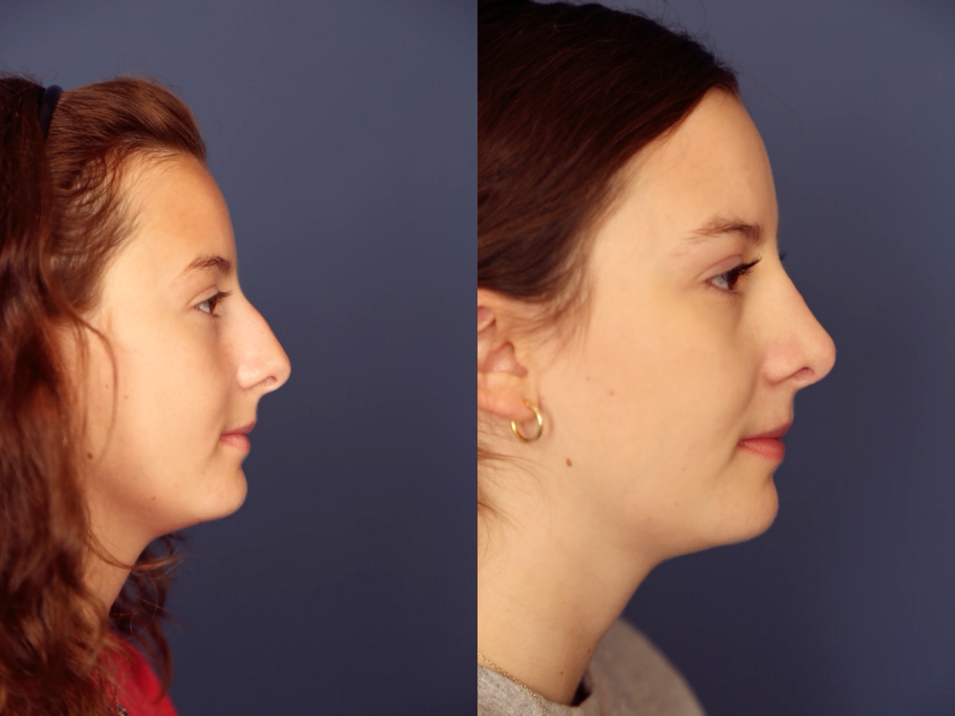 Before and After Image