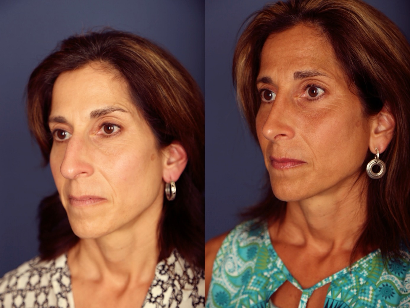 Before and After Image