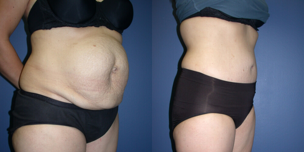 Before and After Image