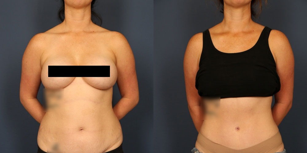 Before and After Image