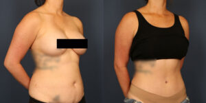 Before and After Image