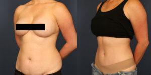 Before and After Image