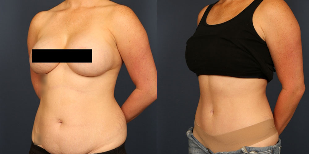 Before and After Image