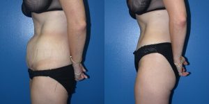 Before and After Image