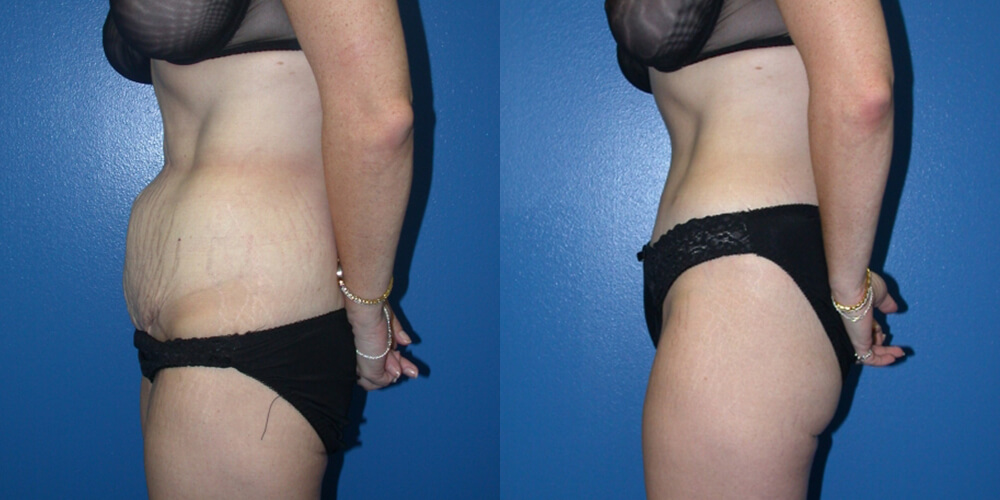 Before and After Image