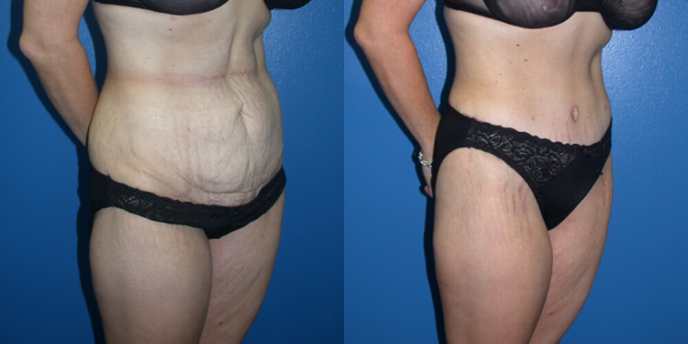 Before and After Image