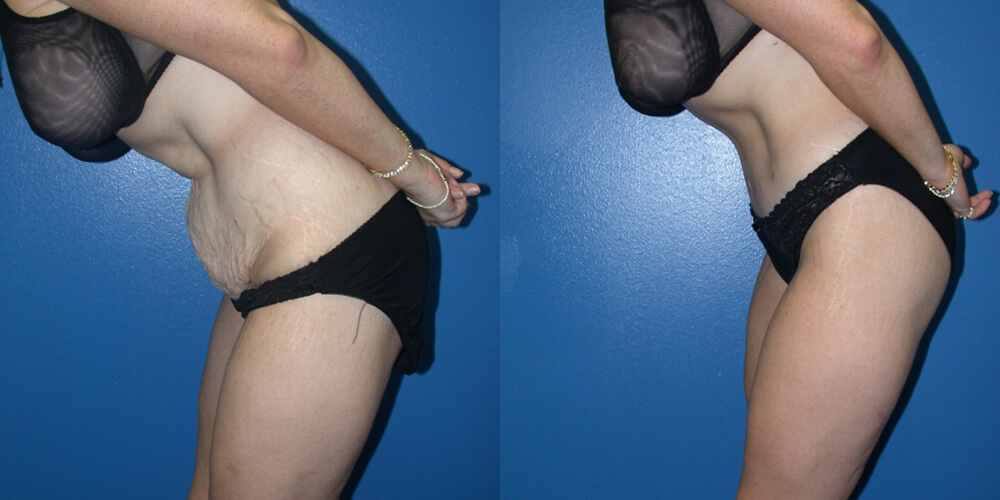 Before and After Image