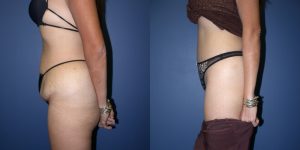 Before and After Image