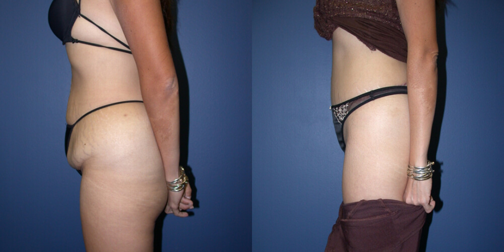 Before and After Image