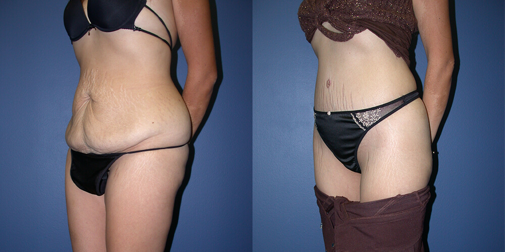 Before and After Image