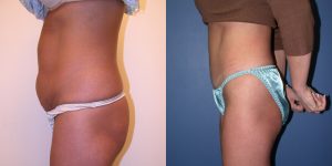 Before and After Image