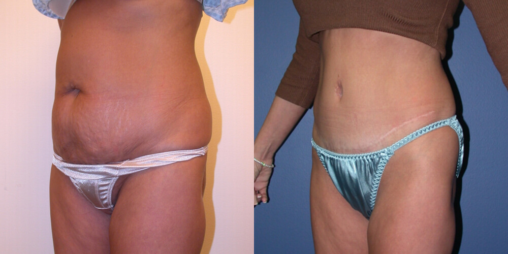 Before and After Image