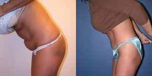 Before and After Image