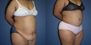 Before and After Image