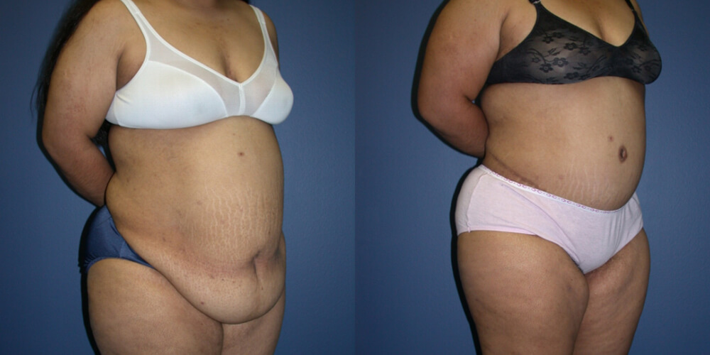 Before and After Image