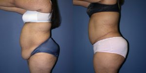 Before and After Image