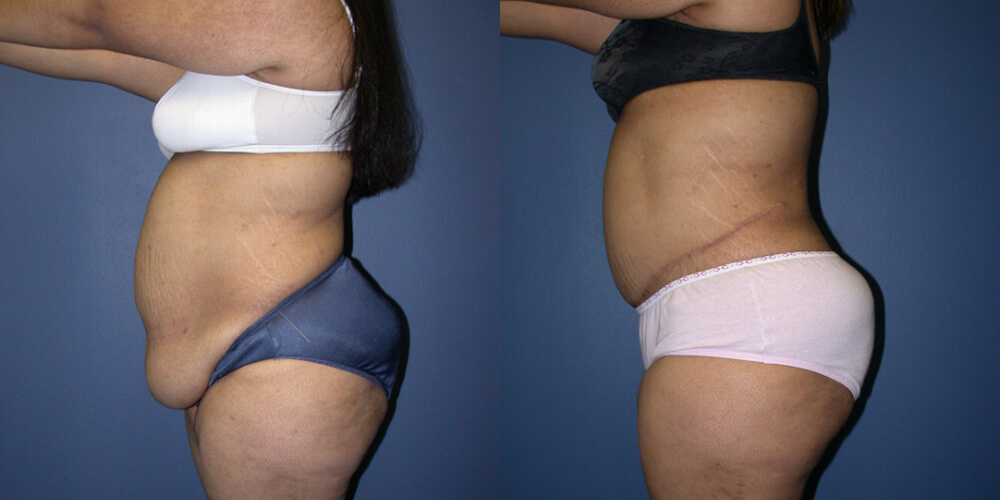 Before and After Image