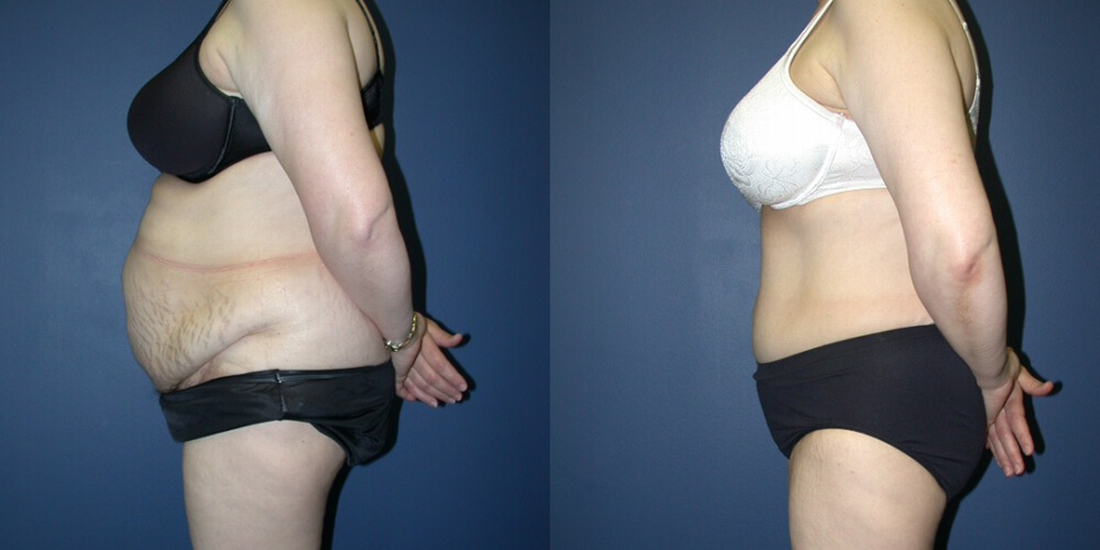 Before and After Image