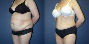 Before and After Image