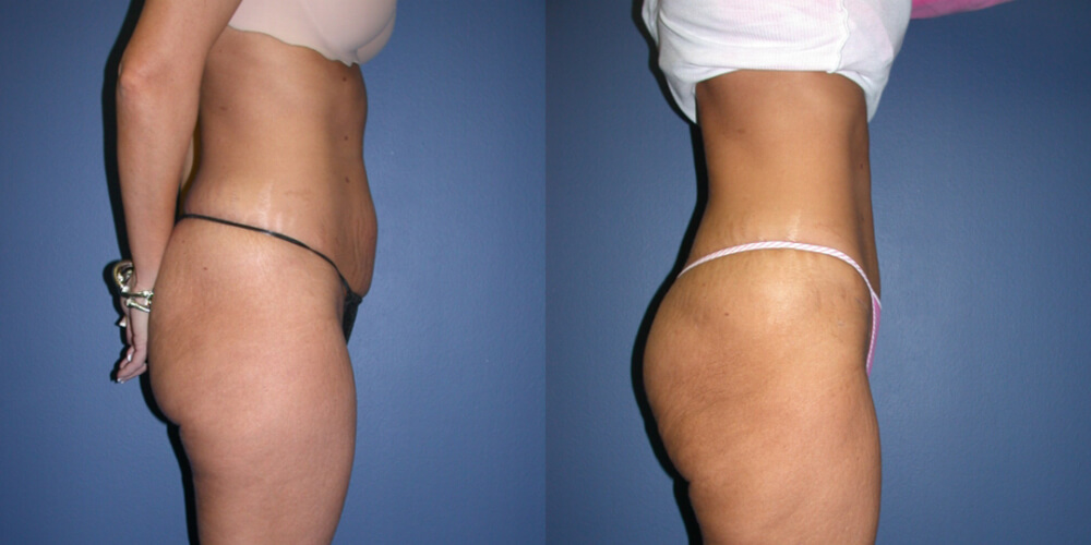 Before and After Image