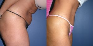 Before and After Image