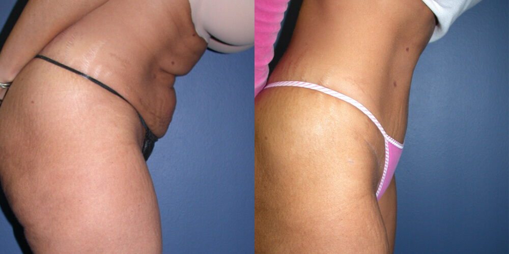 Before and After Image